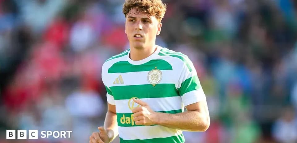 Игрок в полосатой форме Celtic на поле