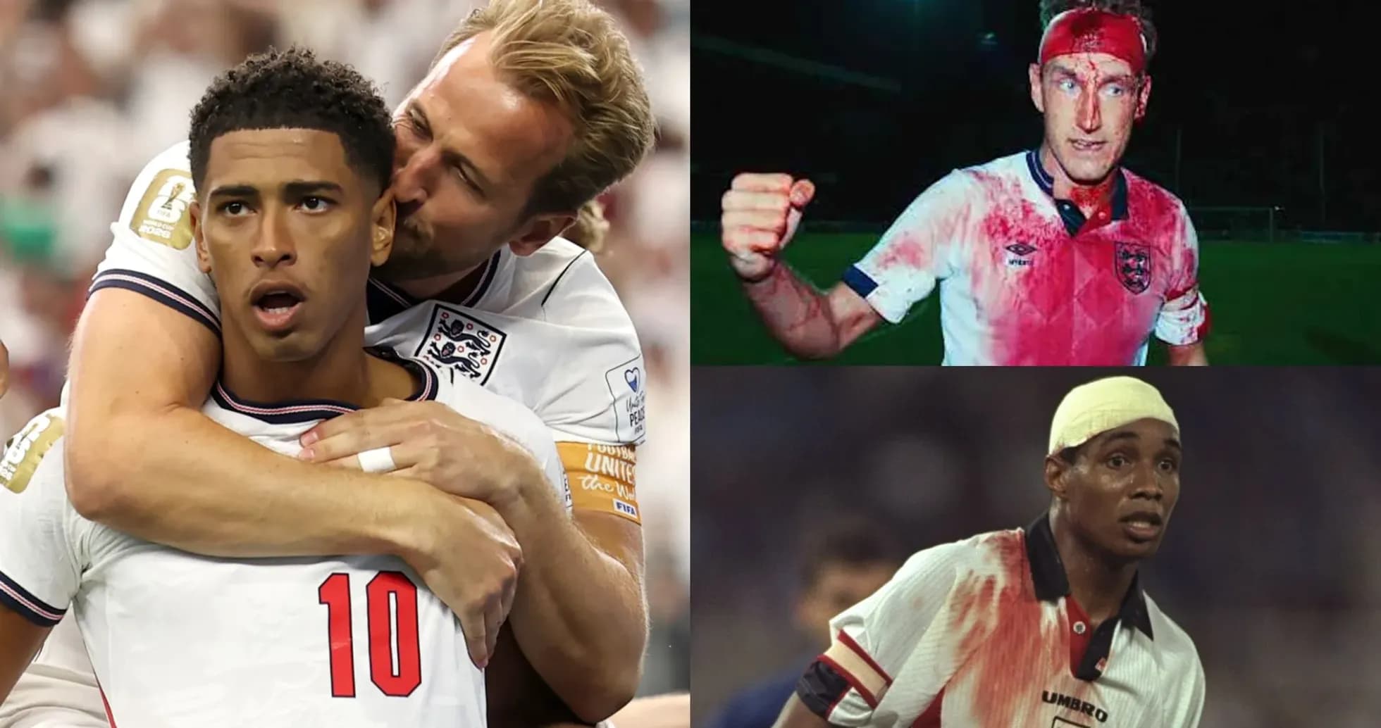 Three football players in England kits with injuries