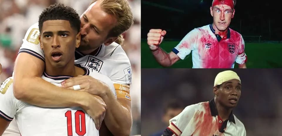 Three football players in England kits with injuries